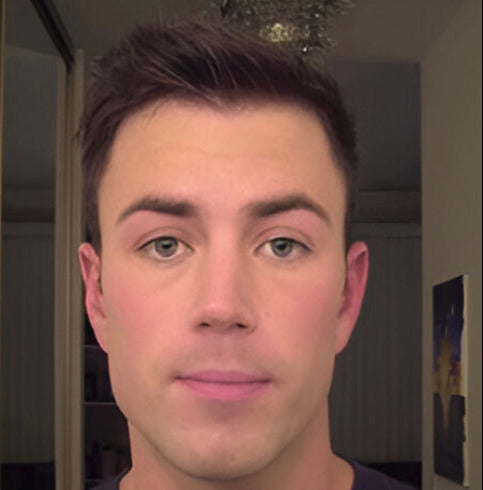 Before and after comparison of a man's face with a neutral background